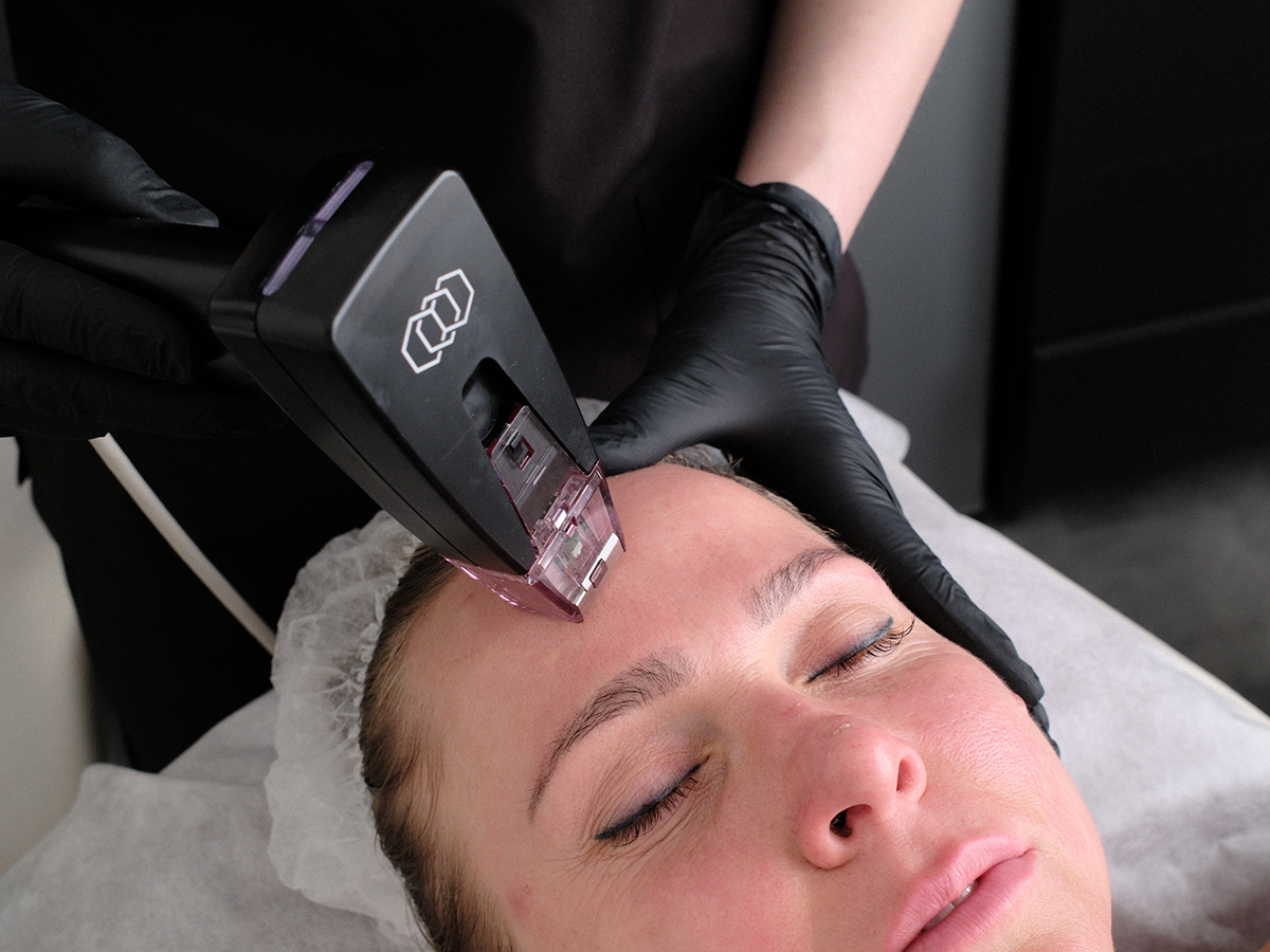 Aparātu kosmetoloģija