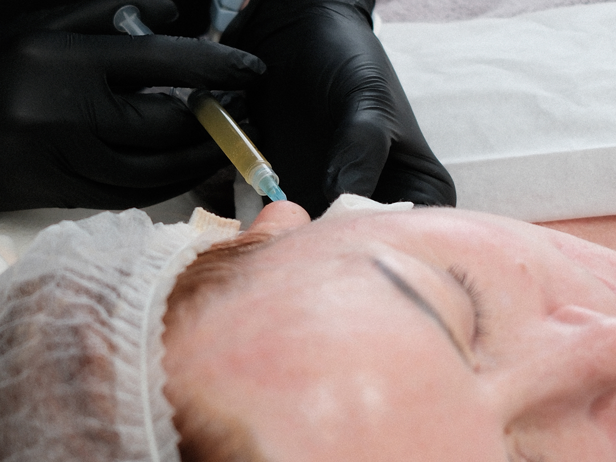 Injekciju kosmetoloģija