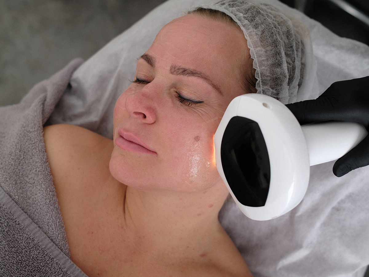 Inovatīva aparātprocedūra sejas ādas atjaunošanai un uzlabošanai. Procedūra ir nesāpīga, efektīva un piemērota dažādu ādas problēmu risināšanai, veicinot ādas mirdzumu un elastību.