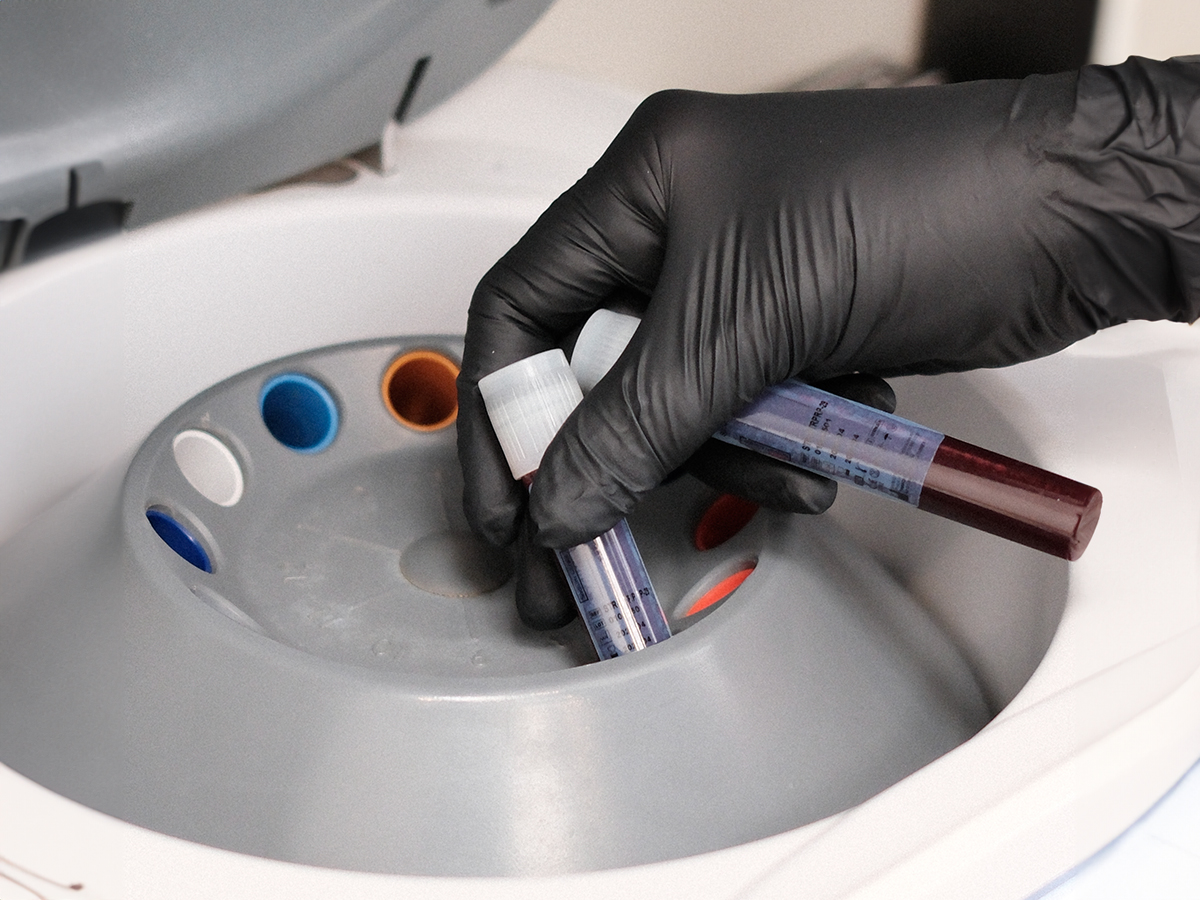 Precīza un sterila asins paraugu apstrāde, kas ir būtiska augstas kvalitātes estētisko un atjaunojošo procedūru nodrošināšanai.