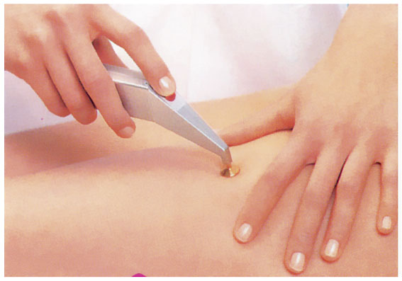 Ādas foto atjaunošana