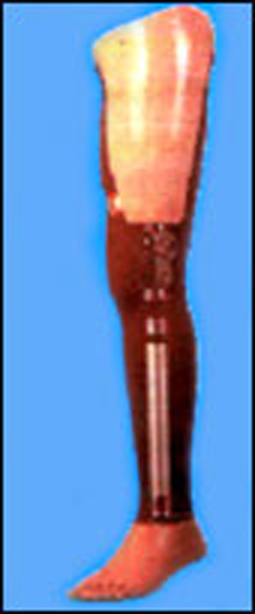 Pieņemšana pēc iepriekšēja pieraksta- protezēšana