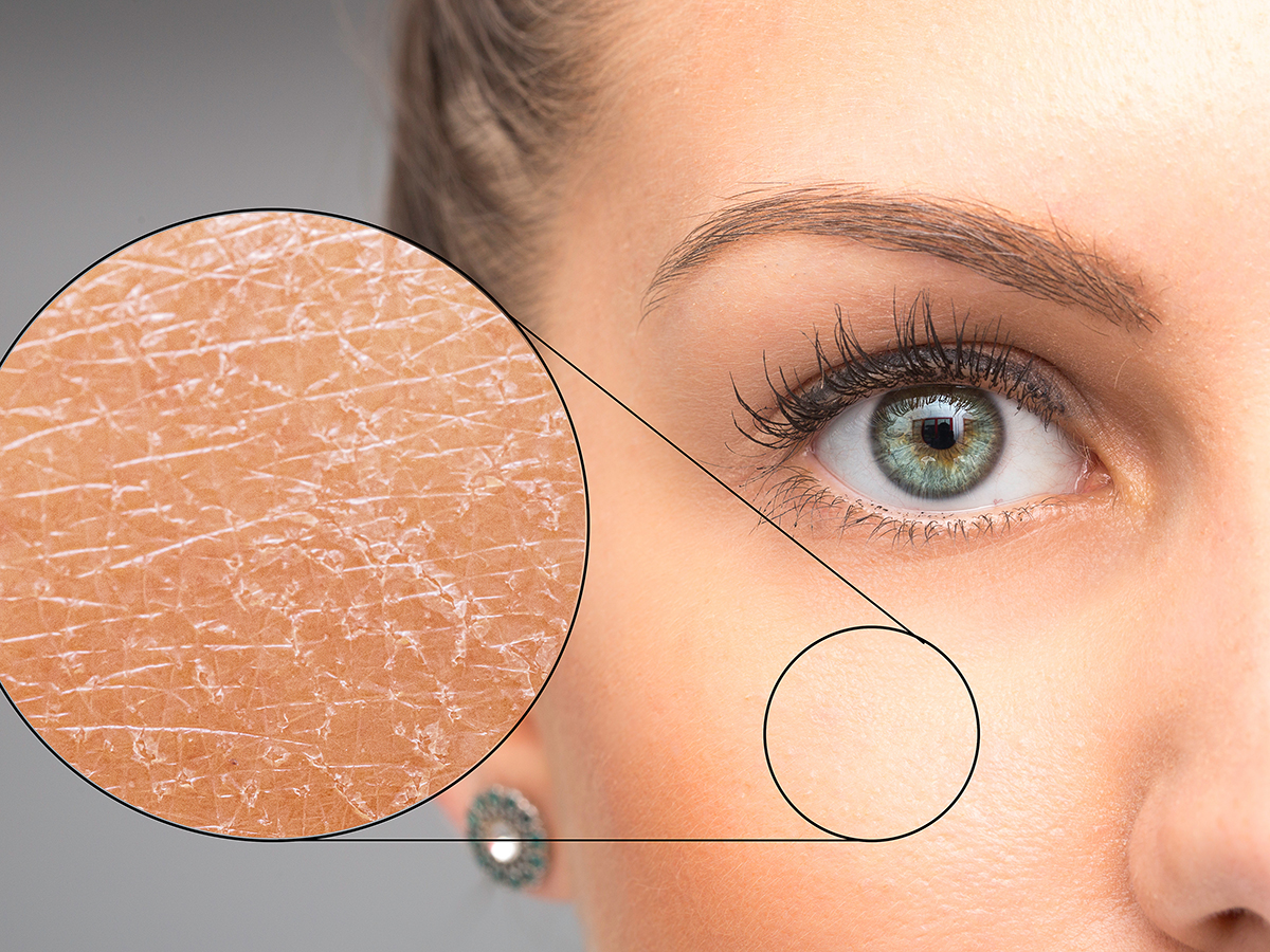 Ādas slimību ārstēšana