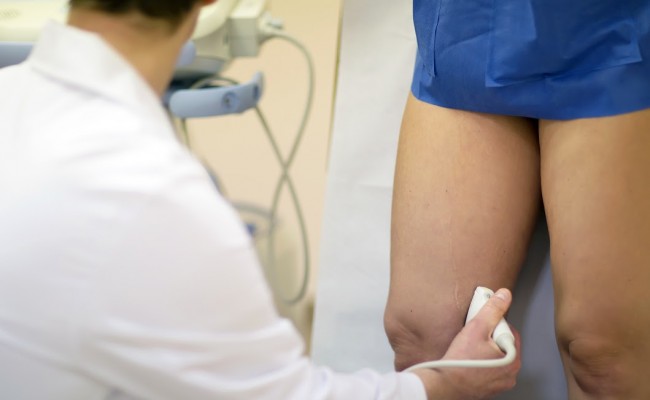 Vēnu diagnostika