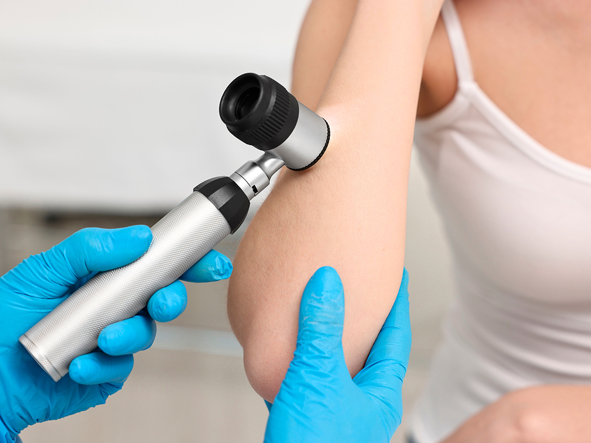 Elkoņa zonas ādas izmeklēšana ar dermatoskopu, izvērtējot ādas struktūru un iespējamas izmaiņas.